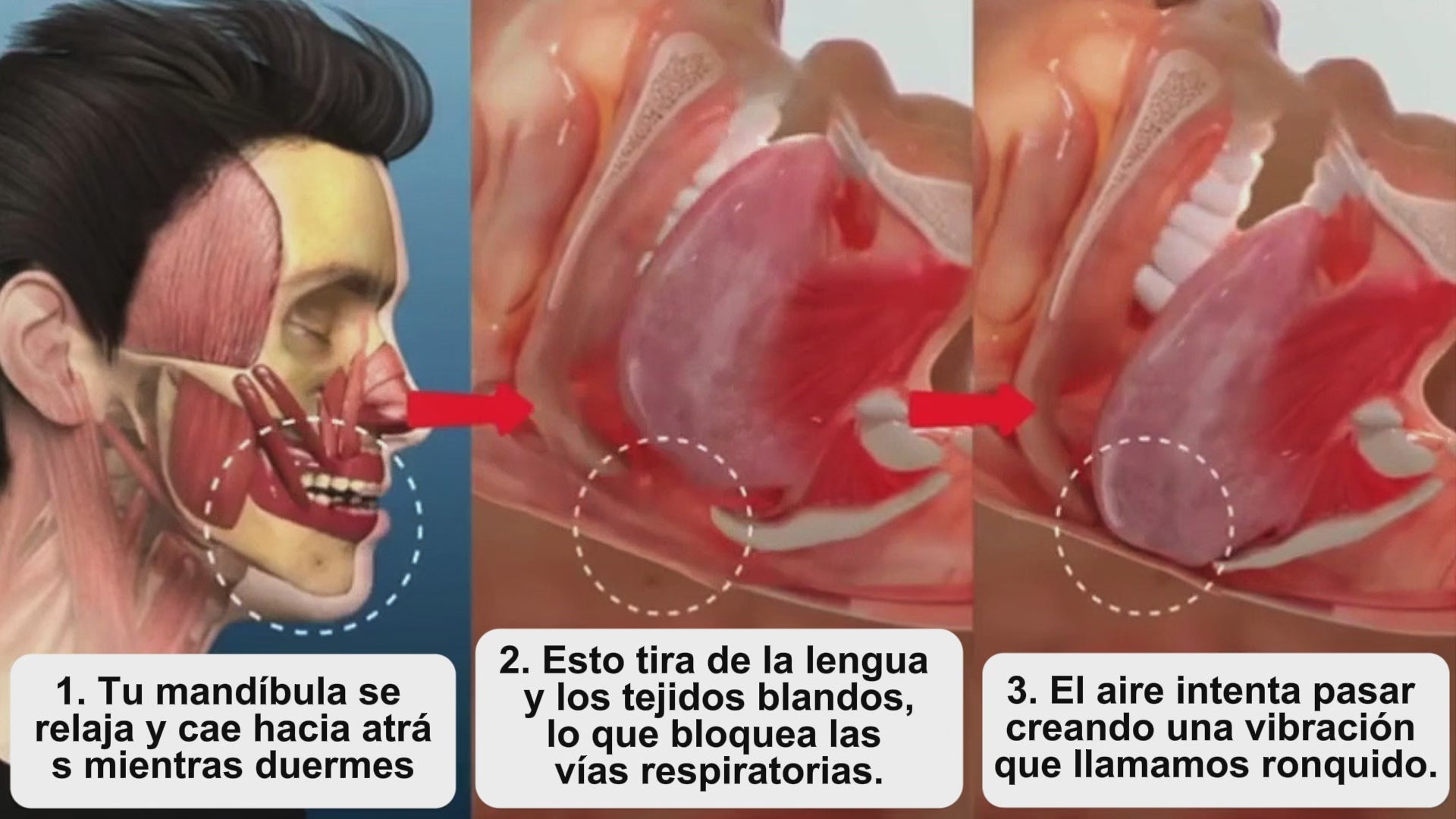 Cargar video: 
